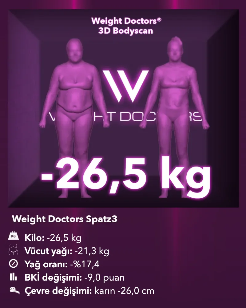 Weight Doctors® 3D Bodyscan öncesi ve sonrası: Spatz3 mide balonu ile 26,5 kg eksi, vücut yağı 21,3 kg eksi