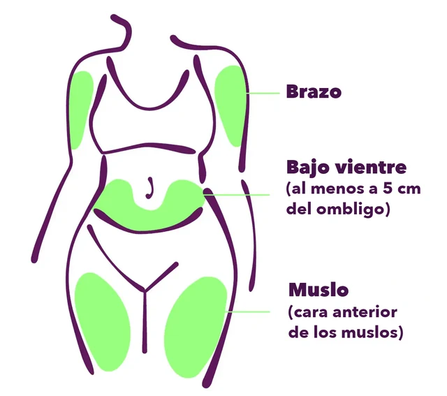 Las posibles zonas de inyección: brazo, parte baja del abdomen (al menos a 5 cm del ombligo) y cara anterior de los muslos