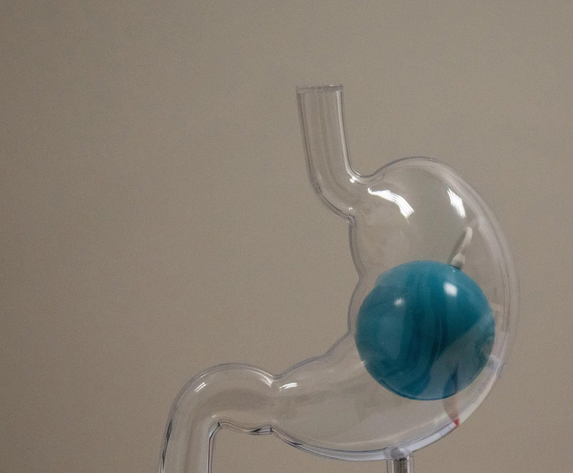 Durchsichtiges Magenmodell mit einem Magenballon