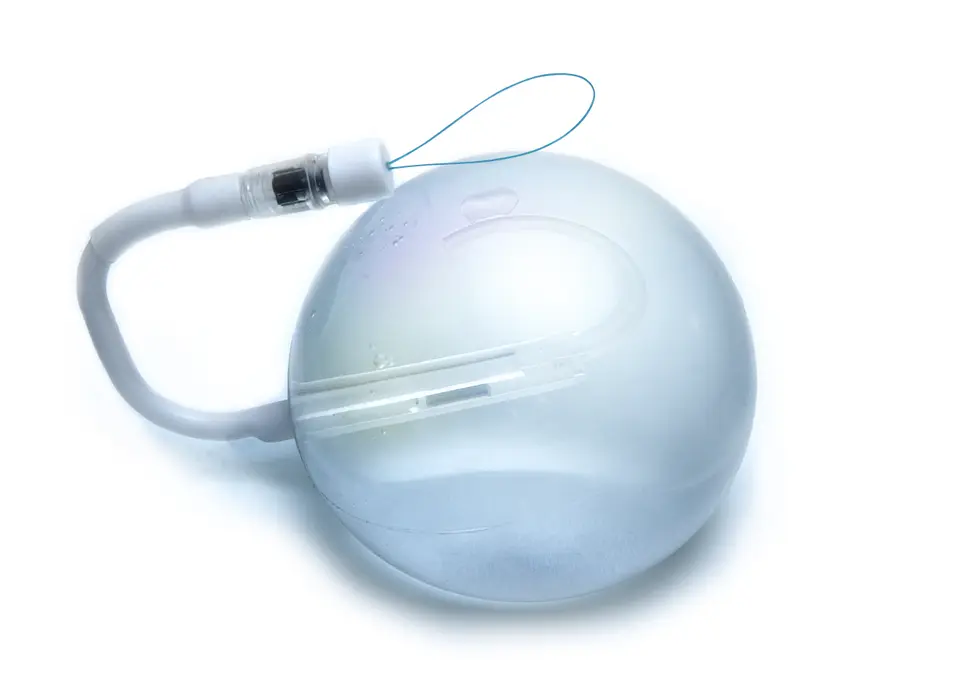 Le ballon gastrique Spatz3 réglable, rempli, avec valve et cathéter